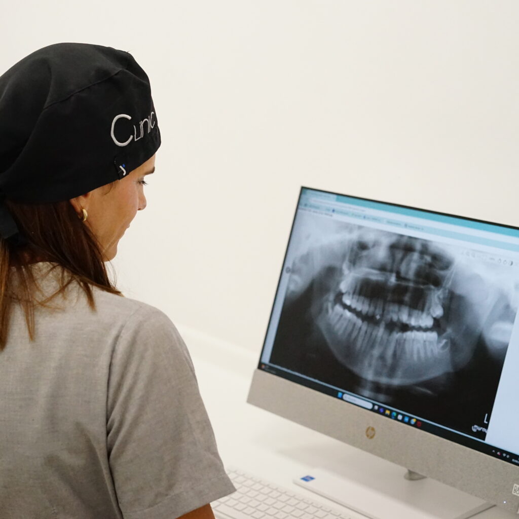 implante dental tarragona